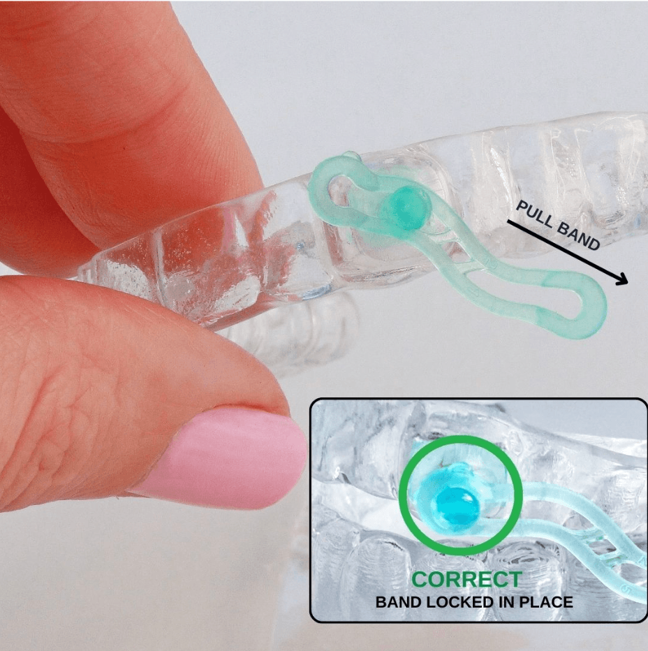 Top Mouthpiece Orientation