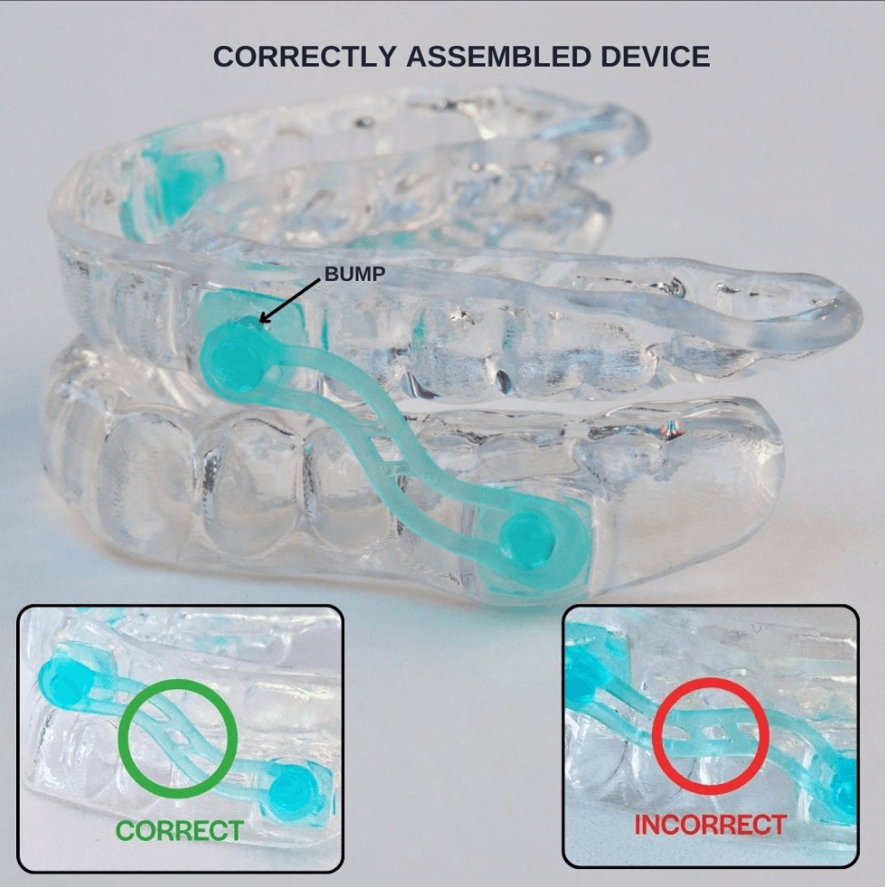 Correctly Assembled Device with Bands